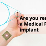 Human Microchip Implant - Medical RFID